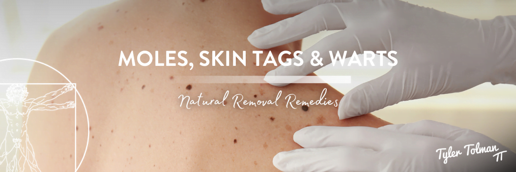Natural healing of Moles, SkinTags, Warts