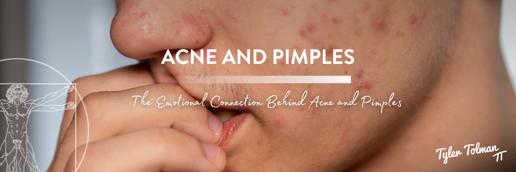 Emotional Connection to Acne & Pimples